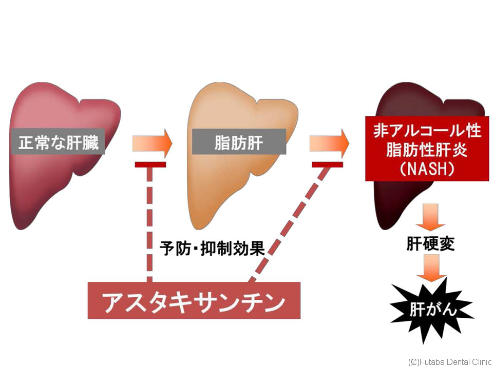 アスタキサンチン さいたま市北区 宮原町 日進町 歯医者 雙葉デンタルクリニック